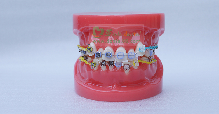 TM-B1-02 Orthodontic Model